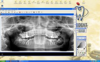 Pantomogram cyfrowy z widocznymi zębami mądrości.